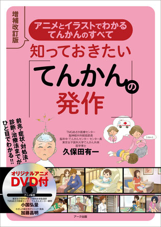 てんかん dvd