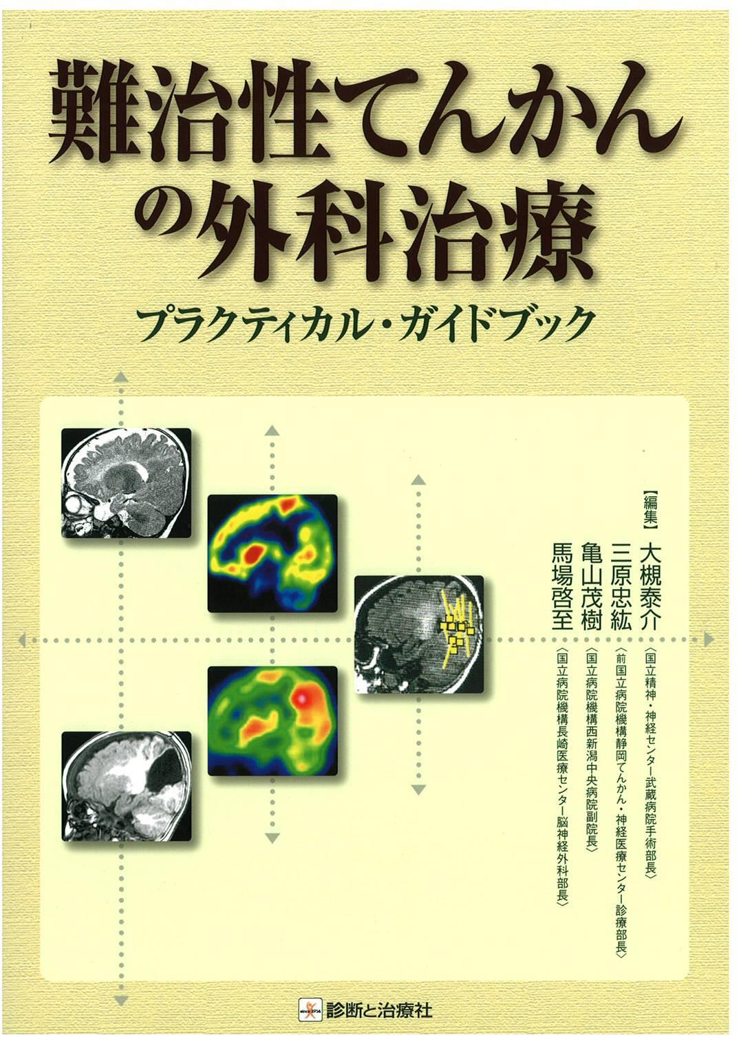 難治性てんかんの外科治療 公益社団法人 日本てんかん協会